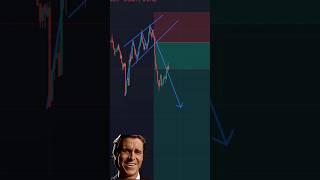 Olymp Trade Basics: Easy Strategy for Beginners!  #OlympTrade #TradingTips #FinanceMadeSimple