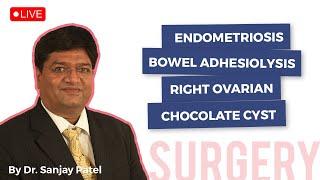 Endometriosis Bowel Adhesiolysis Right Ovarian Chocolate Cyst| Mayflower Women's Hospital