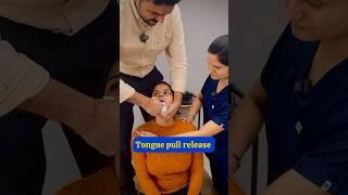 Tongue pull release benefits #feed #trend #feedshort