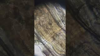 inside a microorganism. #microorganism #parasite