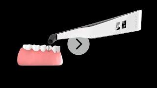 How to measure implant stability with Osstell Beacon