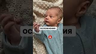 МАЛЫШ СМОТРИТ С ПОВОРОТОМ ГОЛОВЫ В ОДНУ СТОРОНУ #онлайнконсультации #малыш #груднички