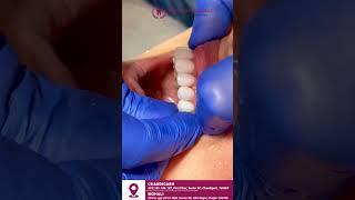 Best dentist in Chandigarh | The Smile Designers | #thesmiledesigners #shortvideo #dentalclinic