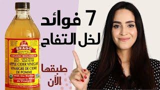 فوائد خل التفاح وطرق استخدامه