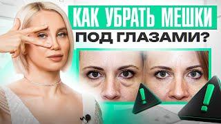 3 ошибки коррекции носослезной борозды, которые приведут к КАТАСТРОФЕ!