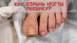 Как стричь ногти ребенку? Как подстричь ногти?