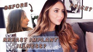 8 MONTH NOSE JOB UPDATE + PLASTIC SURGERY Q&A
