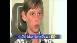 CBS 2 News - Dr. Michael Niccole Helps Repair a Young Boy's Ears