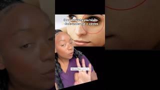 3 Reasons Why You have Dark-Under Eye circles 