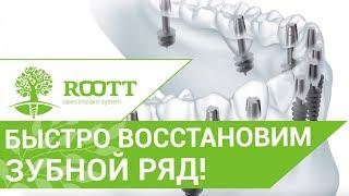 Имплантация зубов новые технологии.  Система ROOTT применяет новейшие технологии в имплантации.