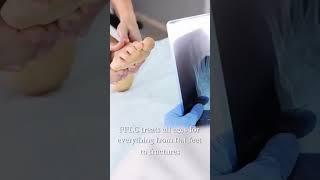 Foot, Ankle, and Leg Pain? FFLC Treats It All | Expert Podiatry in SWFL