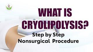 What is Cryolipolysis? Nonsurgical Live Procedure of Cryolipolysis Treatment & Facts (CoolSculpting)