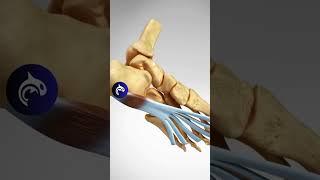 See what Plantar Fasciitis looks like in 3D Animation #feet #foot #heelpain