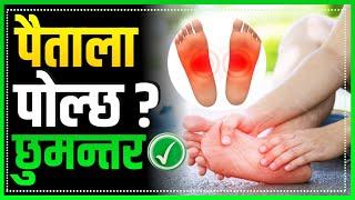 अब पैतला पोल्ने समस्या बाट मुक्ती || Burning feet/foot pain cause and treatment  in Nepali