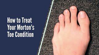 How to Treat your Morton's Toe - Foot Geekz