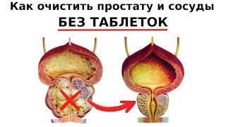 Что делать, если холестерин застрял в Простате и сосудах полового члена