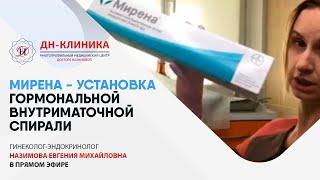 МИРЕНА - УСТАНОВКА внутриматочной гормональной спирали