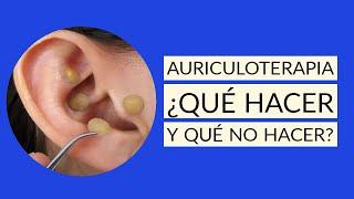 AURICULOTERAPIA aplicacion correcta puntos  FUNCIONA? 