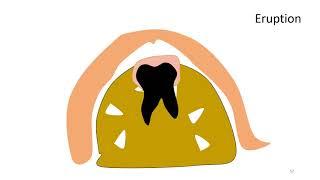 Odontogenic cysts