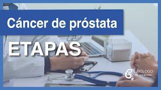 Cáncer de próstata - Etapas │URÓLOGO Josué Ortiz