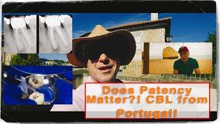 Retreatment Success Without Apical Patency? CBL Vlog from Algarve Portugal