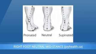 Foot Pronation And Supination - What Is The Difference?