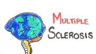 What Is Multiple Sclerosis?