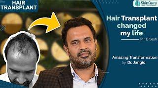 Hair Transplant Changed My Life? | Best Hair Transplant Surgeon - Dr. Jangid | Delhi