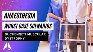 Duchenne's Muscular Dystrophy Anaesthesia Final Exam Case | #anesthesia #duchennemusculardystrophy