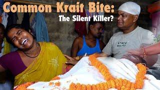 14 साल के लड़के की कॉमन करैत के काटने से जान गई। Common krait bite