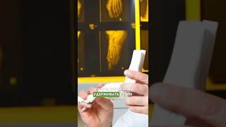 Как лечить плоскостопие