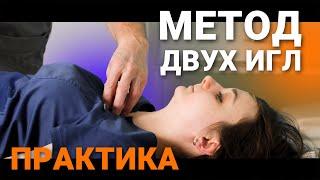 ПРАКТИКА МЕТОДА ДВУХ ИГЛ. Владимир Александров