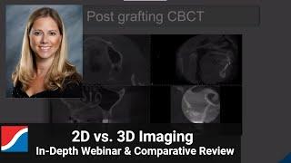 Dr. Heidi Kohltfarber, Dental Radiologist: 2D vs. 3D Imaging Comparative Review