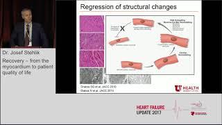 Dr. Josef Stehlik: "Recovery, from the myocardium to patient quality of life"