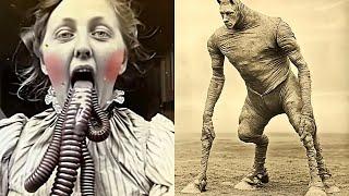 20 Circus Freaks That Actually Existed