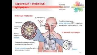 Лекция 3. Тема 2: «Клинические проявления туберкулеза»