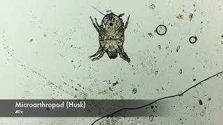 Micro-arthropod - Jahlak's Microscopy