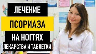 Лечение псориаза ногтей. Лекарства и таблетки от псориаза на ногтях