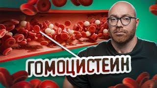 КАК ГОМОЦИСТЕИН МОЖЕТ УГРОБИТЬ ВАШ ОРГАНИЗМ?