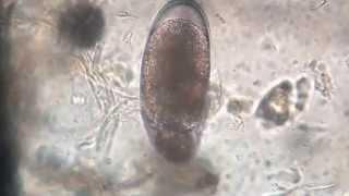 Mite egg