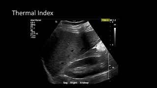 Ultrasound Physics - Image Optimization