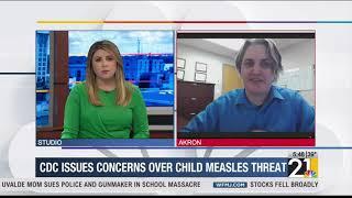 CDC issues concerns over child measles threat