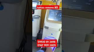 tattoo remove BD / Dhaka tattoo remove / Bangladesh to remove