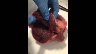 San Dissection