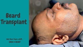 Beard Transplant In India | How to grow dense Beard | Beard Transplant in Mumbai | Navimumbai