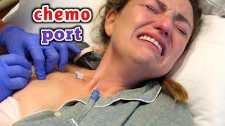 شاهد كيف يتم تركيب جاهز الكيمو بورت للمرضي _ What is the chemo port device?