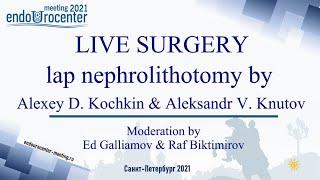 lap nephrolithotomy live/лапароскопическая нефролитотомия/живая хирургия/Кочкин