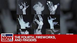 The Fourth, fireworks and lost fingers, how to stay safe this July | LiveNOW from FOX