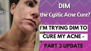 #DIM - the Cystic Acne Cure???? Part 3 Update