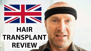 HELLO UK! John's Hair Transplant Experience at AEK Hair Clinic